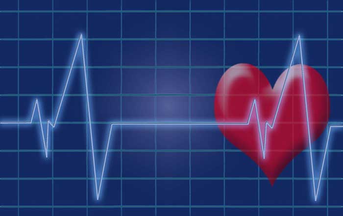 Image of a cardiogram