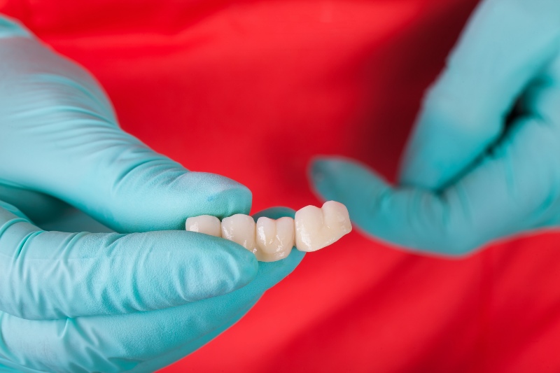 Close-up of dental bridge restoration used to replace missing teeth in Southfield, MI